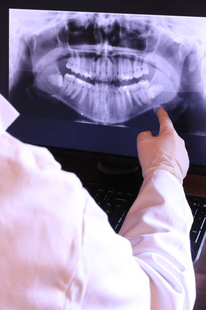 Best Emergency Tooth Extraction in Muldrow, OK