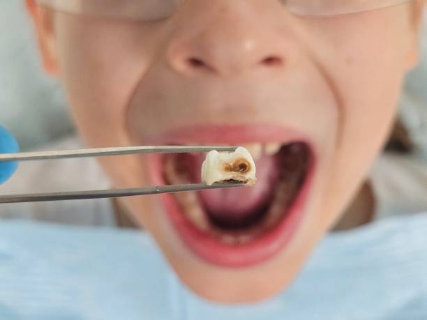 Best Emergency Broken Tooth Repair in Muldrow, OK